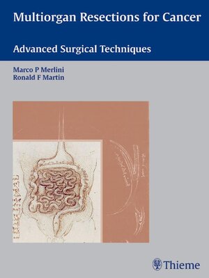 cover image of Multiorgan Resections for Cancer